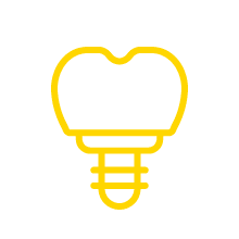 Implantes dentales | Dentistas en Palma de Mallorca