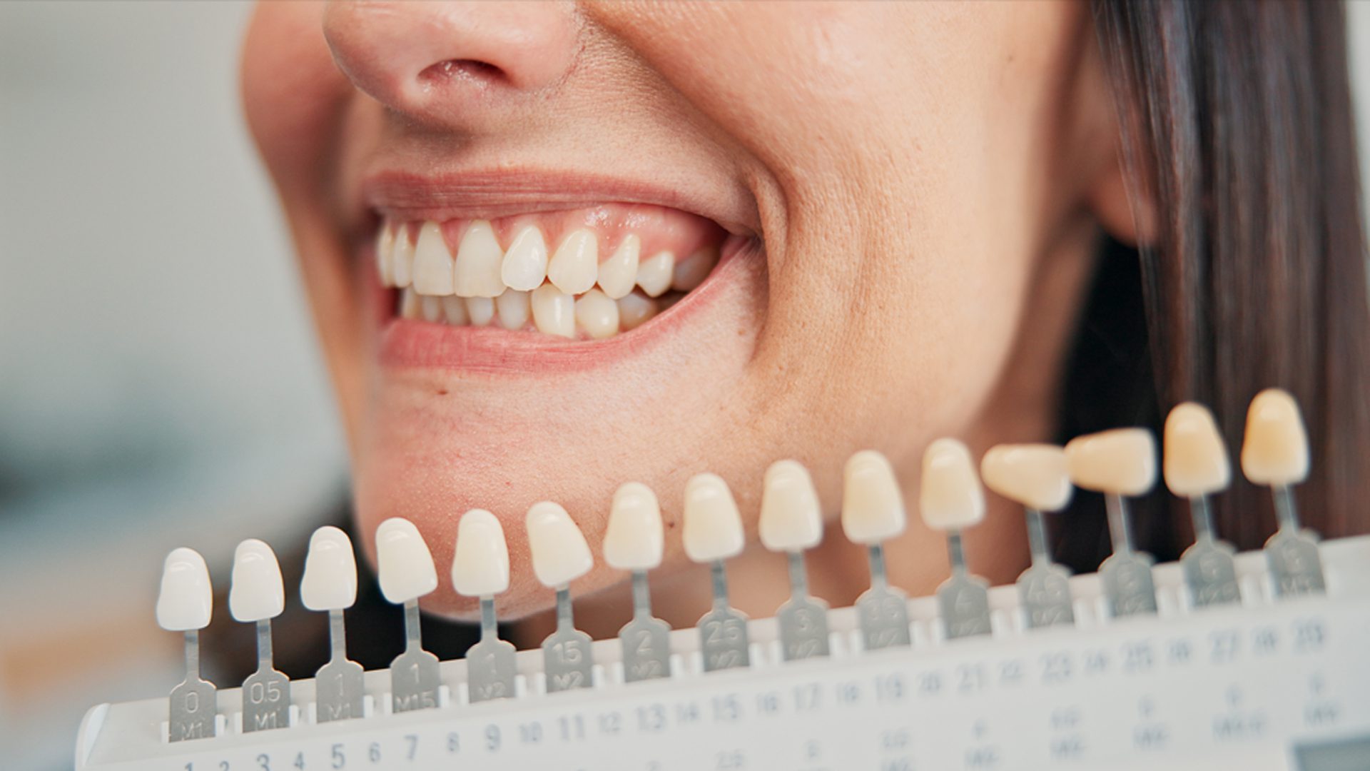 Paso a paso del tratamiento con implantes dentales